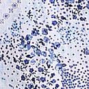 Flowy Ruffle Mini Dress, Blue & White Patchwork Floral, swatch