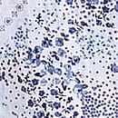 Flowy Ruffle Mini Dress, Blue & White Patchwork Floral, swatch